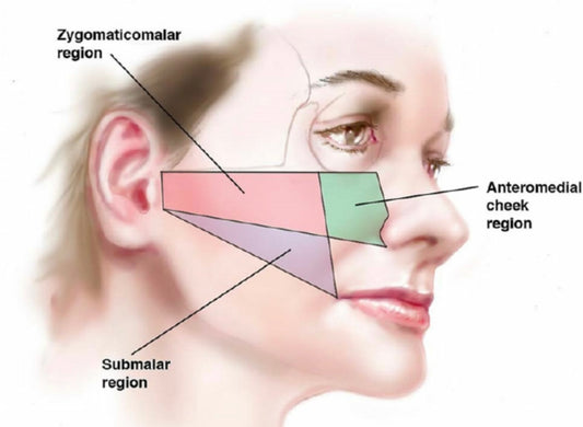 Advanced online masterclass covering the following treatments:  Cheek filler with cannula technique Jawline filler with cannula technique Chin filler  